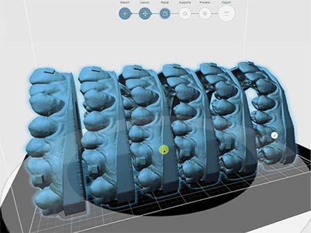 Logiciel de conception orthodontique numérique