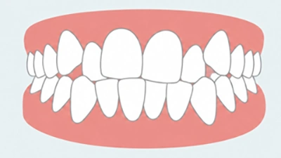 Encombrement dentaire (Chevauchement)
